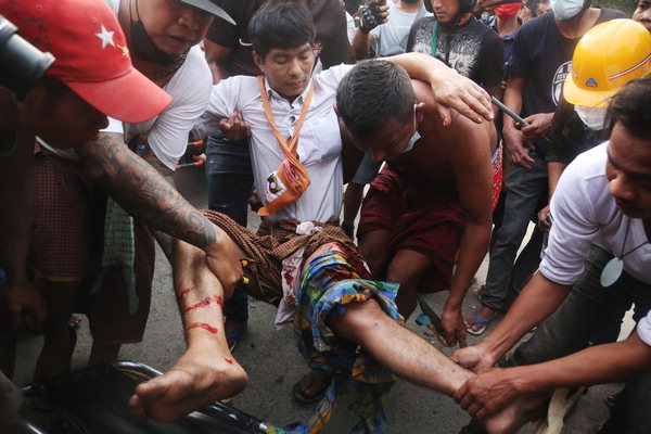 ▲ 미얀마 군부 쿠데타에 항의하는 시위 참여자들이 경찰과 군인들의 폭력으로 큰 부상을 당해 치료를 받고 있다.  /연합뉴스