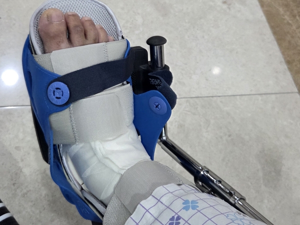 미등록 이주노동자인 베트남 국적 응우옌 하이 당(가명) 씨는 업무 중 법무부 출입국외국인사무소의 단속을 피하다 골절상으로 다리를 다쳤다. /안지산 기자